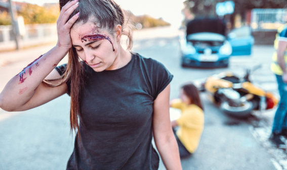 a woman trying to shake off headache after a motorcycle accident in Florida